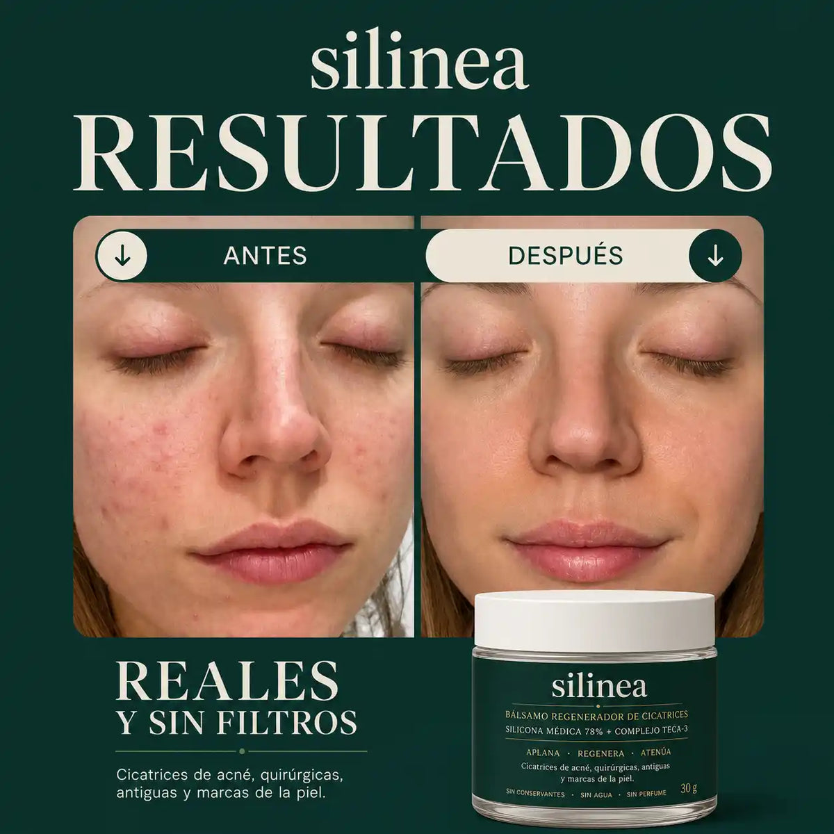 Bálsamo de silicona médica + TECA 3
