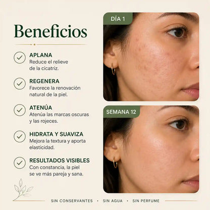 Bálsamo de silicona médica + TECA 3